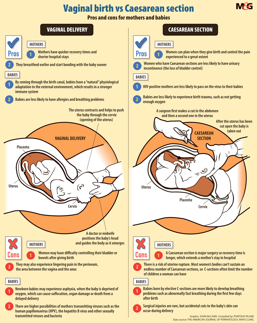 Cesarean Delivery Vs Natural Delivery